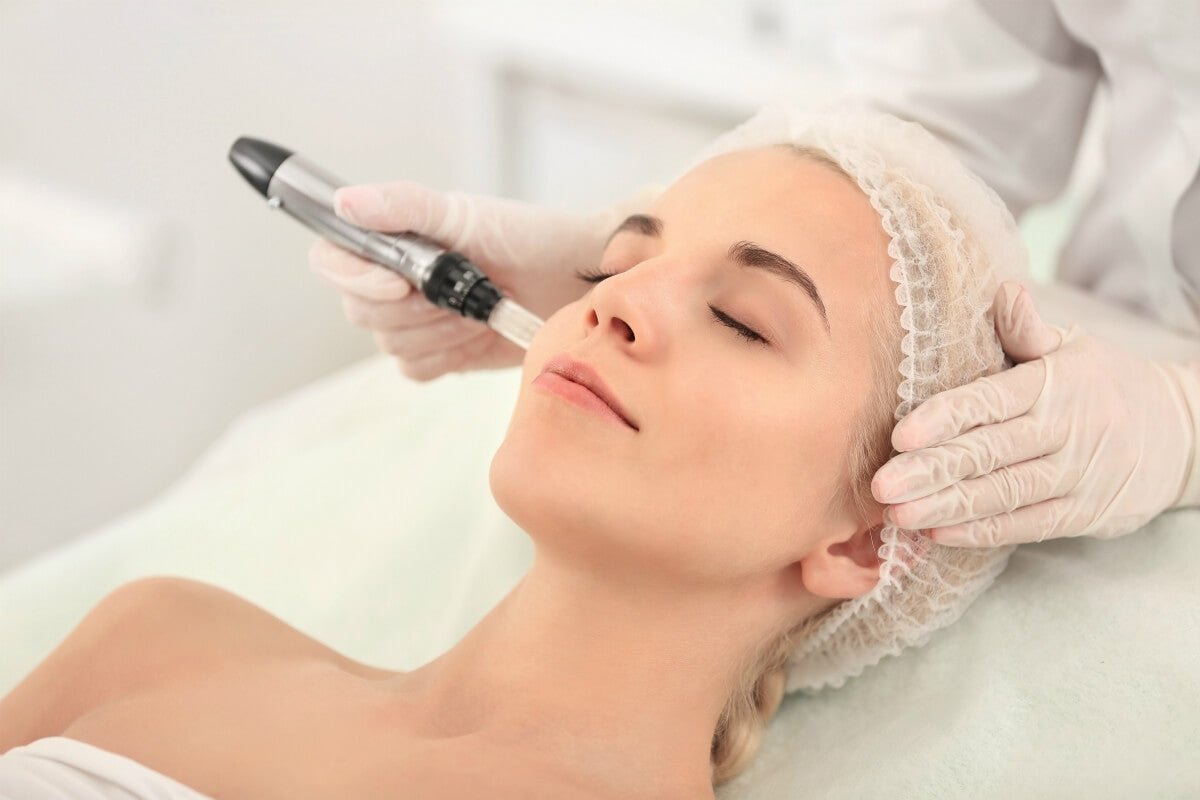How Microneedling Improves Skin Texture and Tone - Wise Aesthetics