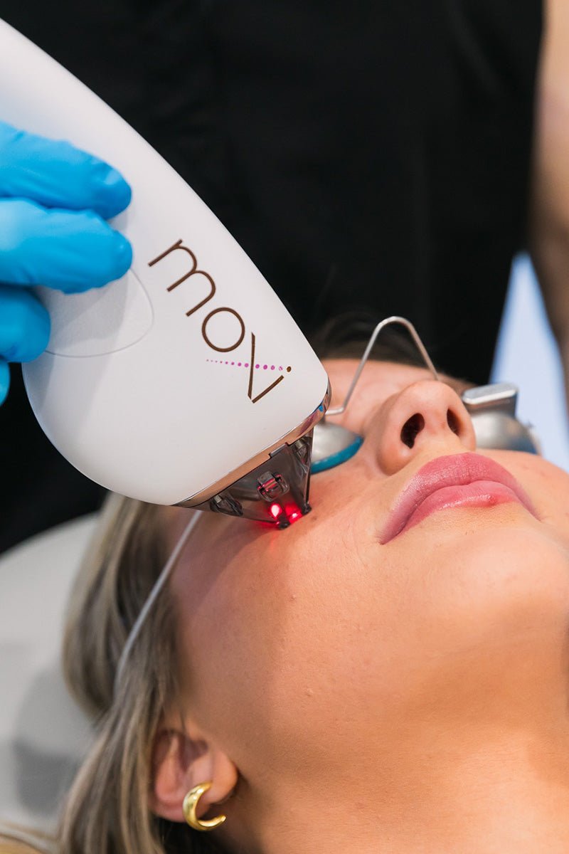 Halo vs. MOXI vs. BBL — Which Treatment Is Right for You? - Wise Aesthetics