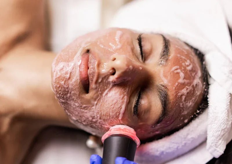 Glo2Facial - Wise Aesthetics