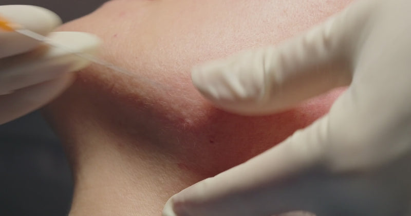 Medical professional performing dermal filler injections to improve contour of the jawline.