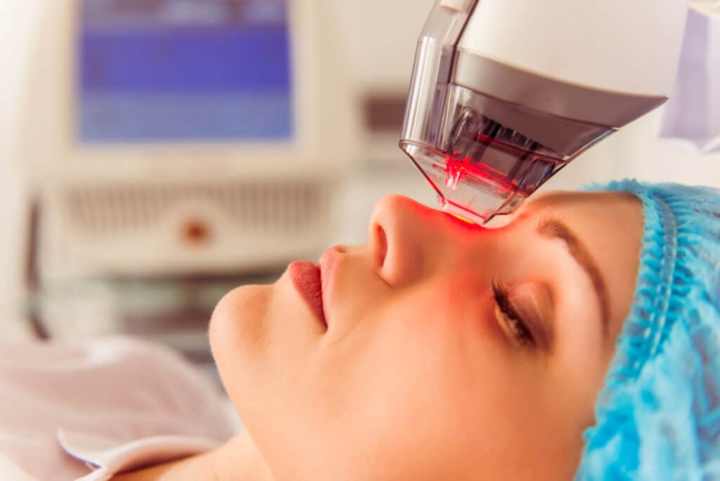 How CoolPeel® Can Transform Aging Skin