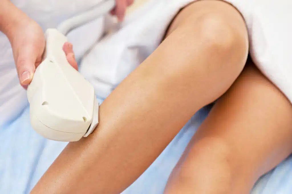 Laser Hair Removal