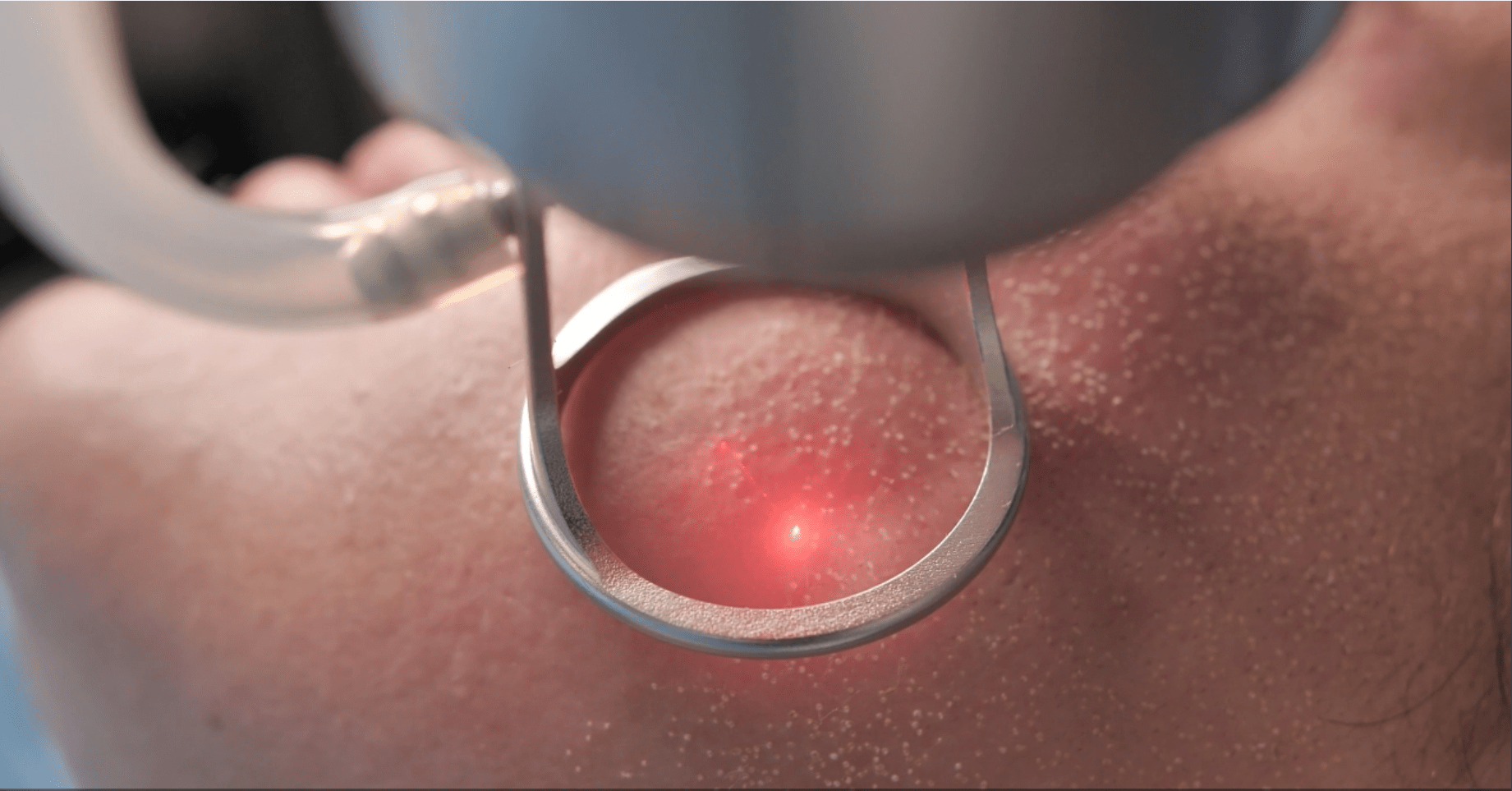 CoolPeel